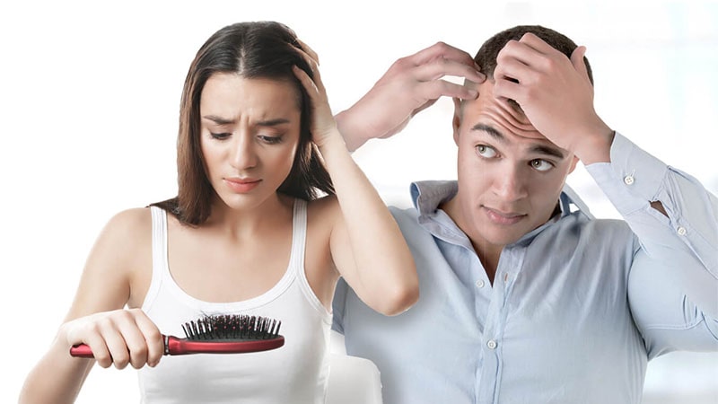 ریزش موهای جلوی سر بیشتر در خانم ها دیده می شود یا آقایان